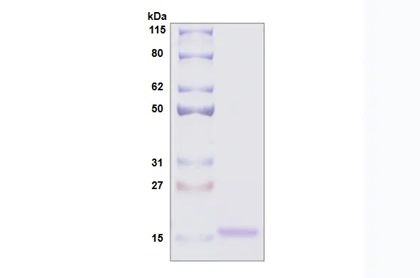 Recombinant Human Galectin 10, His Tag -100 ug